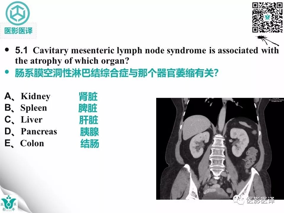 【病例】肠系膜空洞性淋巴结综合症1例CT