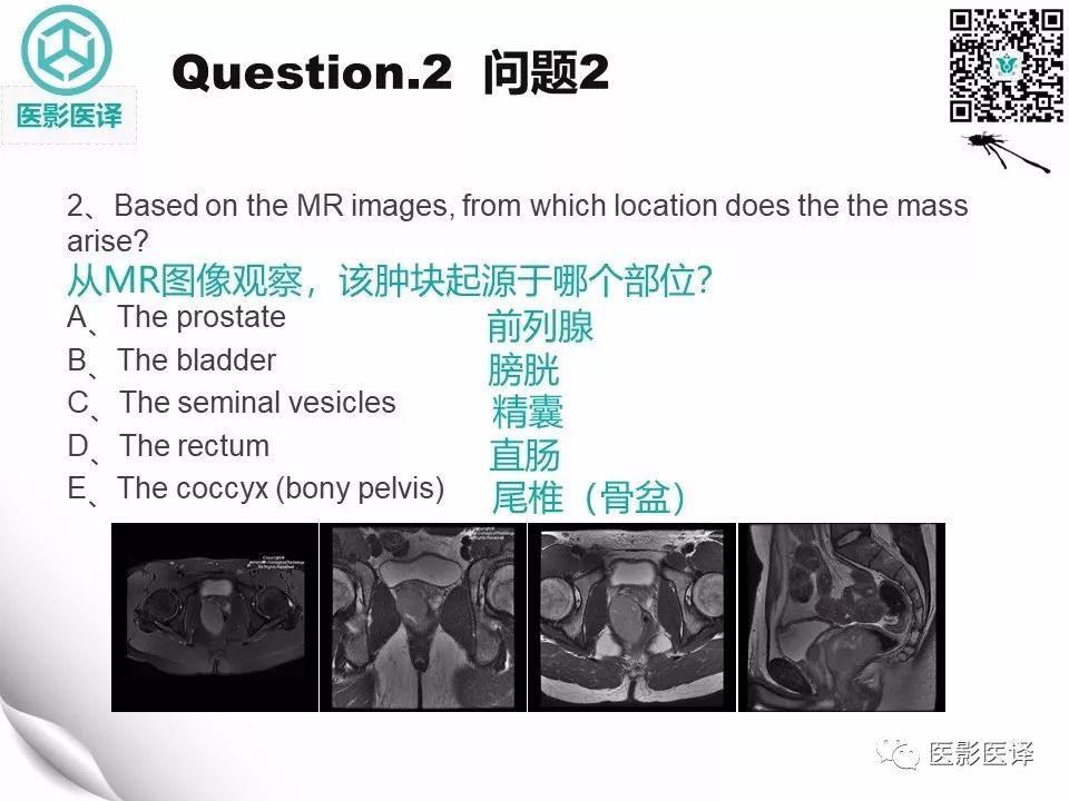 【病例】直肠间质瘤1例CT及MR