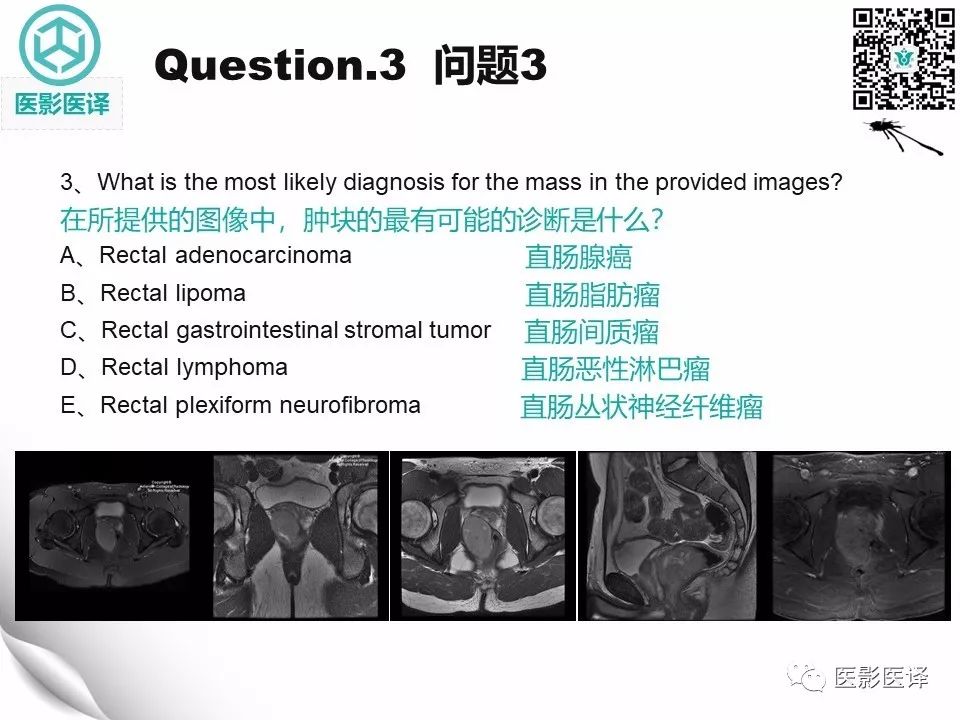 【病例】直肠间质瘤1例CT及MR
