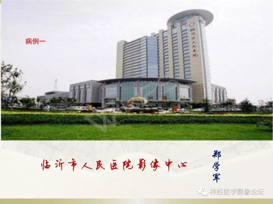 【病例】丘脑对称性病变之乙脑1例CT及MR