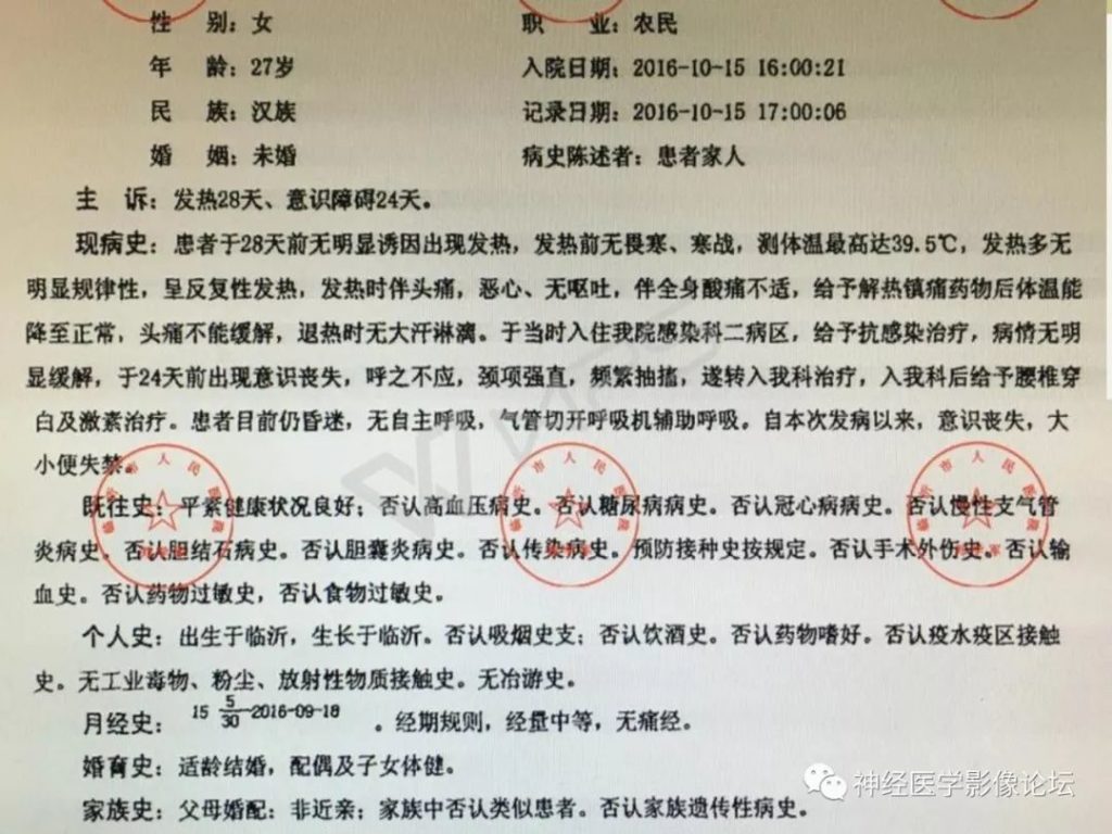 【病例】丘脑对称性病变之乙脑1例CT及MR