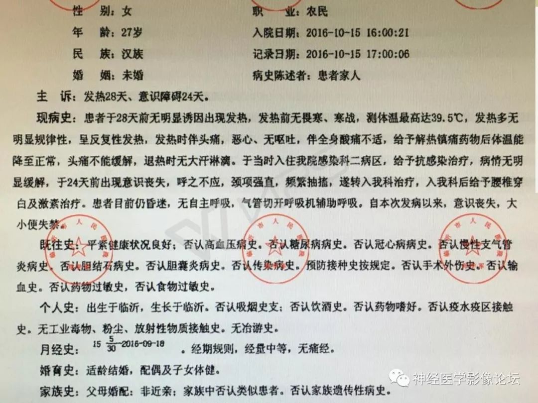 【病例】丘脑对称性病变之乙脑1例CT及MR