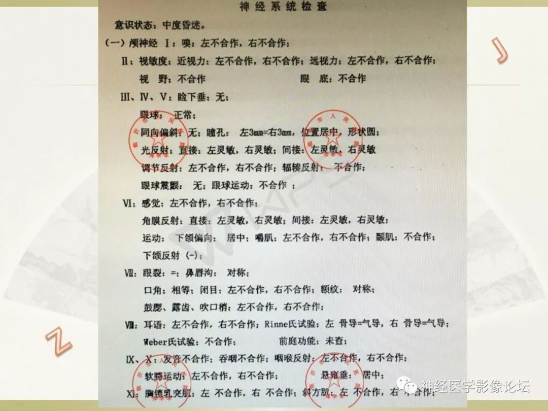 【病例】丘脑对称性病变之乙脑1例CT及MR