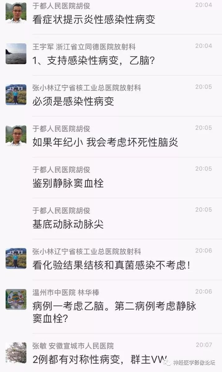 【病例】丘脑对称性病变之乙脑1例CT及MR