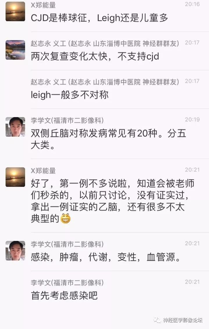 【病例】丘脑对称性病变之乙脑1例CT及MR