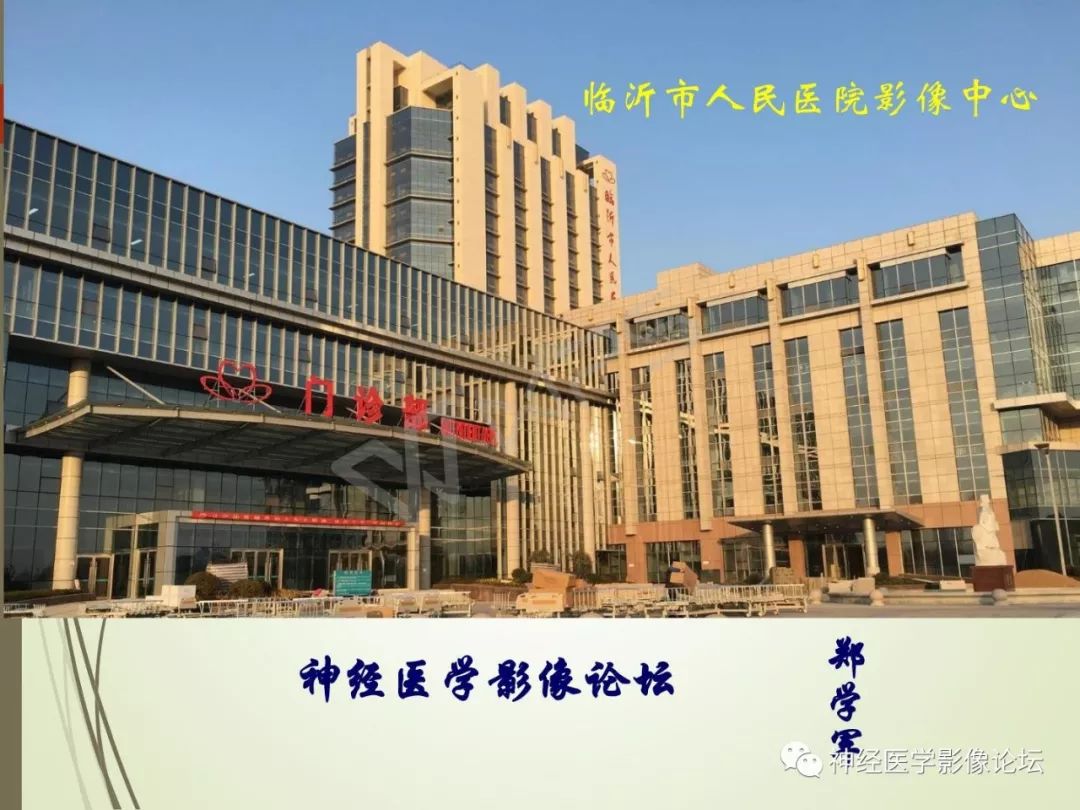 【病例】丘脑对称性病变之硬脑膜动静脉瘘并丘脑-基底节区静脉性脑梗塞1例CT及MR