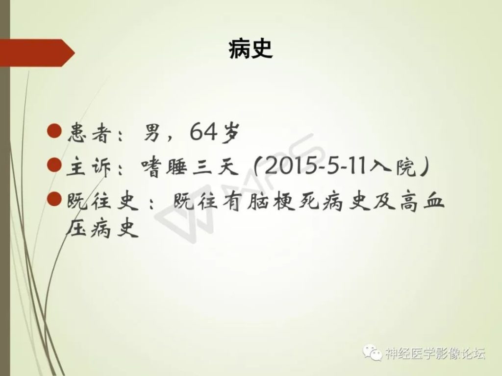 【病例】丘脑对称性病变之硬脑膜动静脉瘘并丘脑-基底节区静脉性脑梗塞1例CT及MR