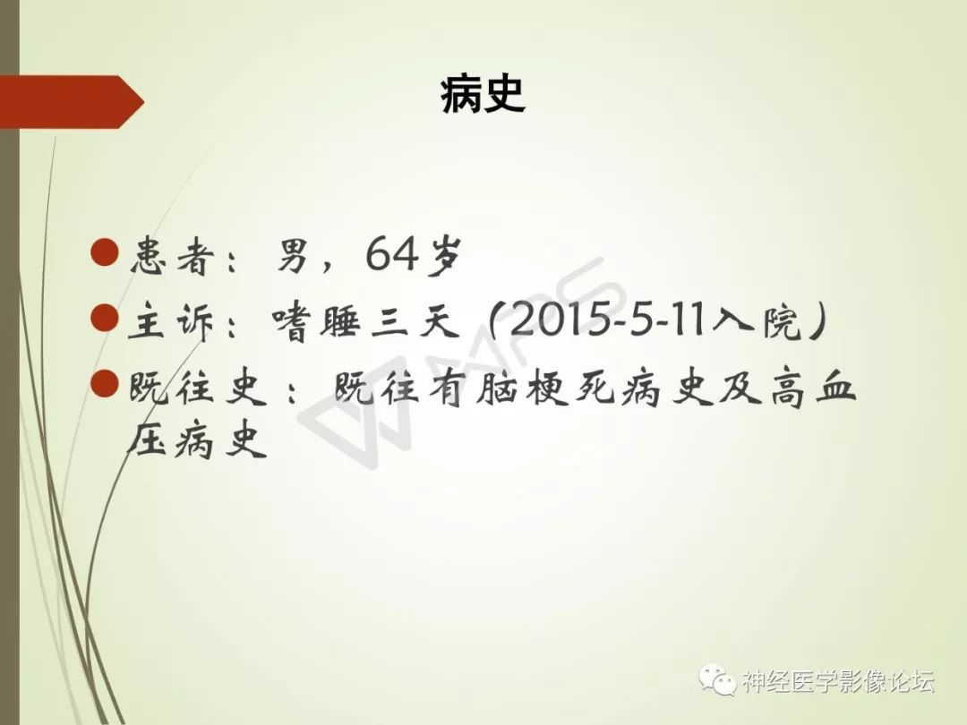 【病例】丘脑对称性病变之硬脑膜动静脉瘘并丘脑-基底节区静脉性脑梗塞1例CT及MR