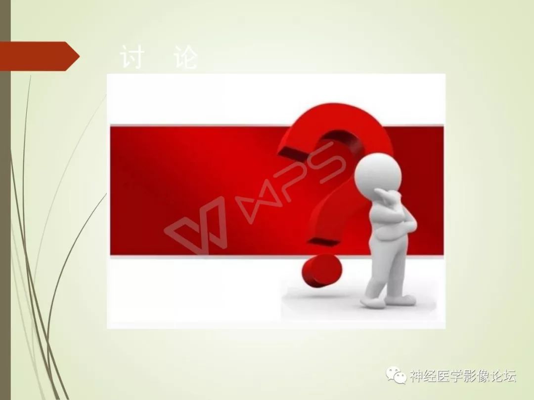 【病例】丘脑对称性病变之硬脑膜动静脉瘘并丘脑-基底节区静脉性脑梗塞1例CT及MR