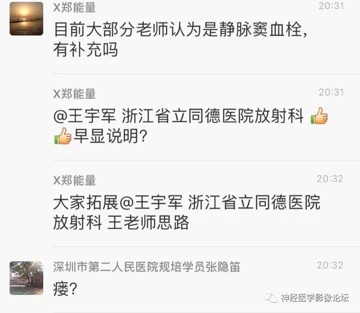 【病例】丘脑对称性病变之硬脑膜动静脉瘘并丘脑-基底节区静脉性脑梗塞1例CT及MR