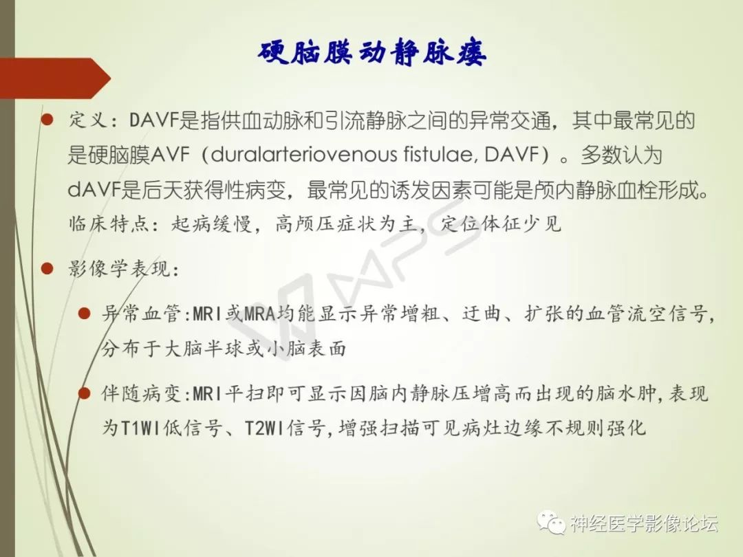 【病例】丘脑对称性病变之硬脑膜动静脉瘘并丘脑-基底节区静脉性脑梗塞1例CT及MR