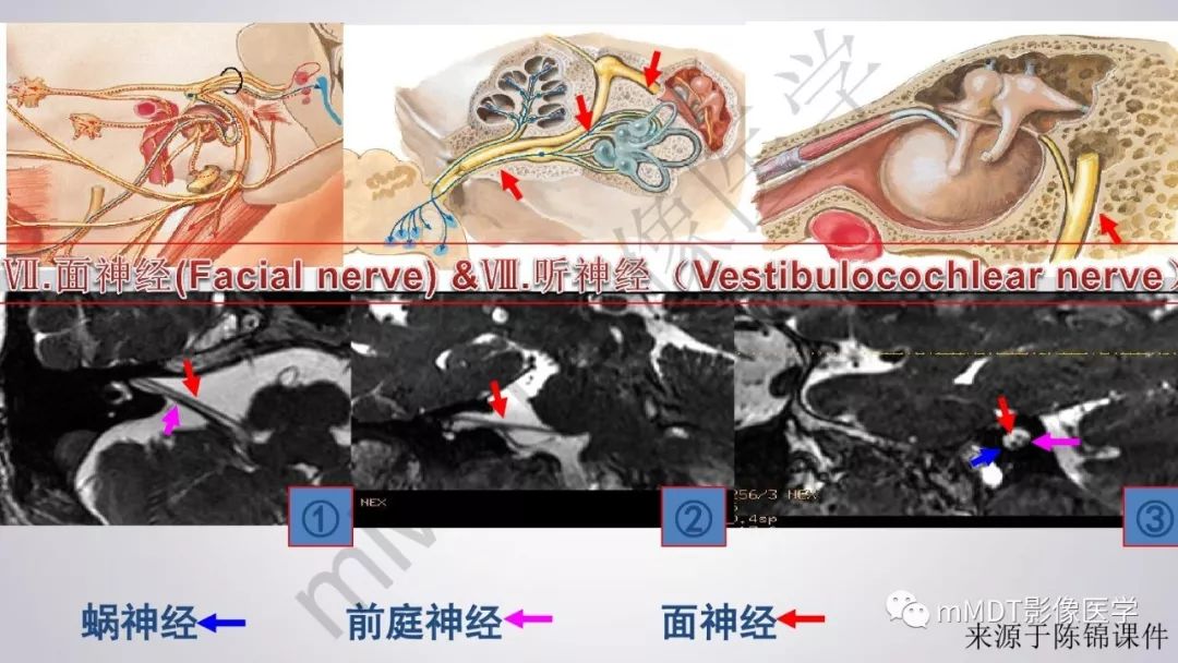 【PPT】后颅窝常见肿瘤的诊断