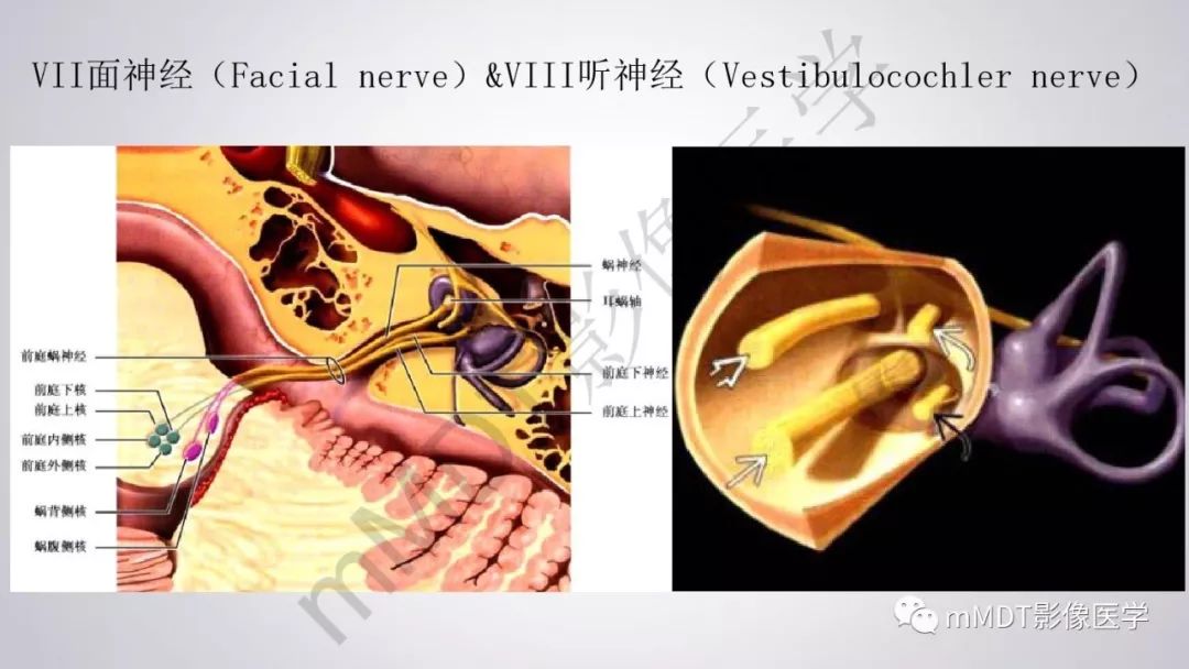 【PPT】后颅窝常见肿瘤的诊断