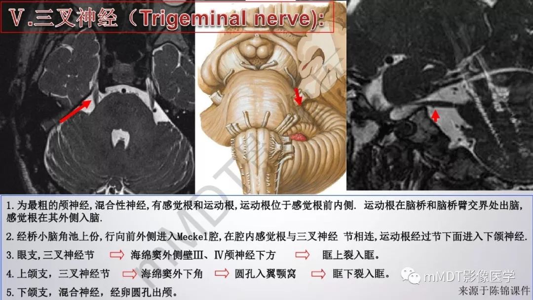 【PPT】后颅窝常见肿瘤的诊断