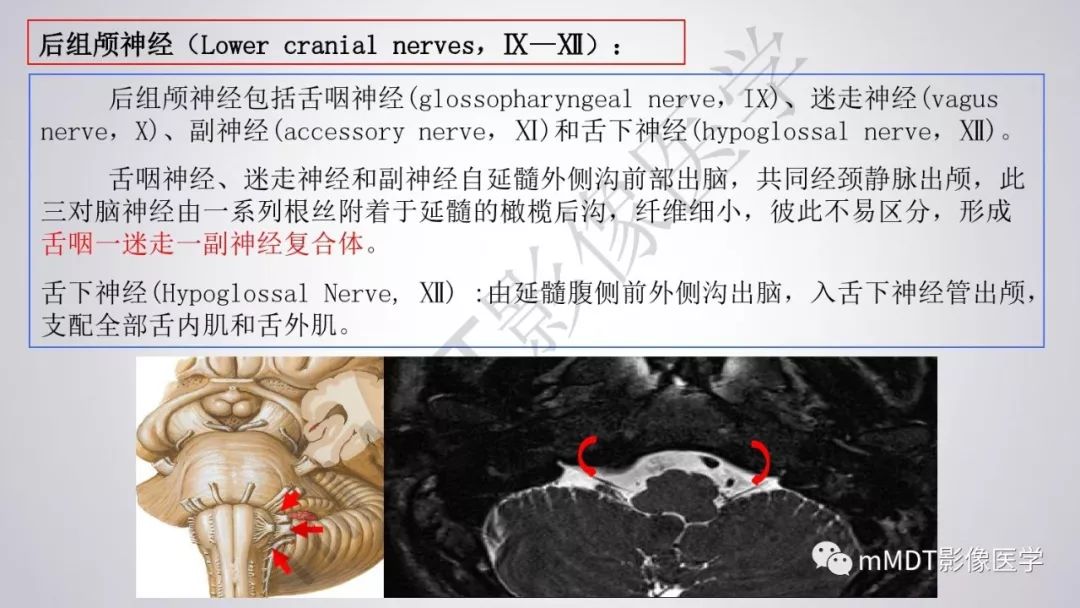 【PPT】后颅窝常见肿瘤的诊断
