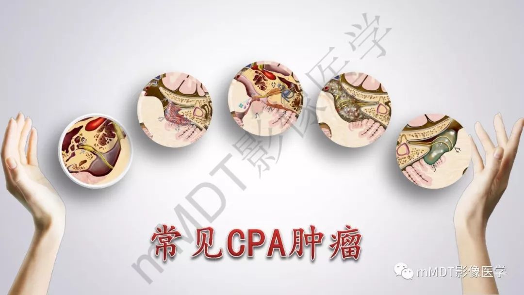 【PPT】后颅窝常见肿瘤的诊断