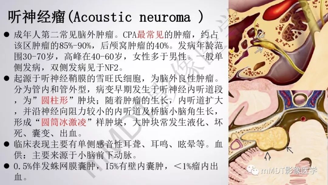 【PPT】后颅窝常见肿瘤的诊断
