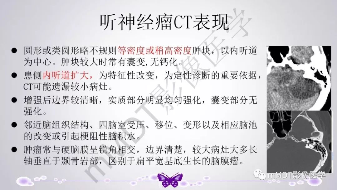 【PPT】后颅窝常见肿瘤的诊断