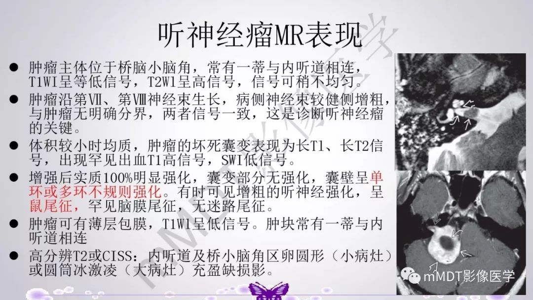 【PPT】后颅窝常见肿瘤的诊断