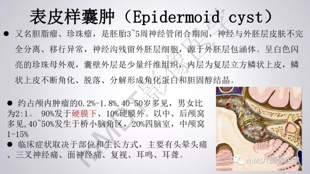 【PPT】后颅窝常见肿瘤的诊断