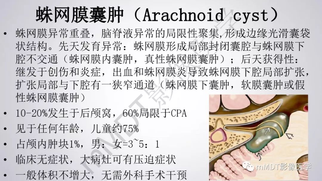 【PPT】后颅窝常见肿瘤的诊断