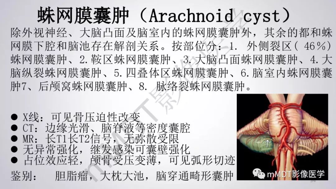【PPT】后颅窝常见肿瘤的诊断