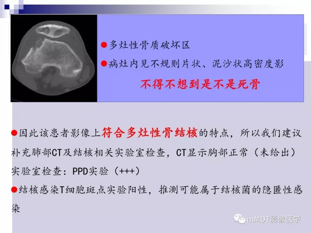 【PPT】多灶性骨病影像分析思路(不常见感染篇)
