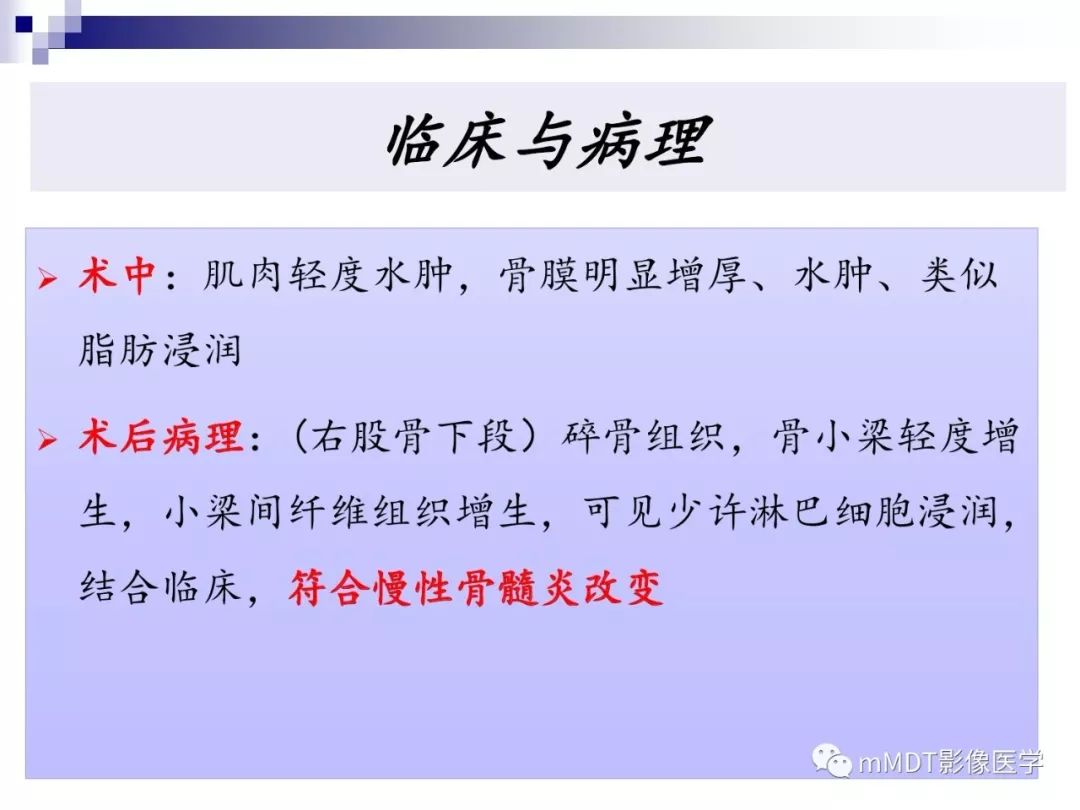 【PPT】多灶性骨病影像分析思路(不常见感染篇)