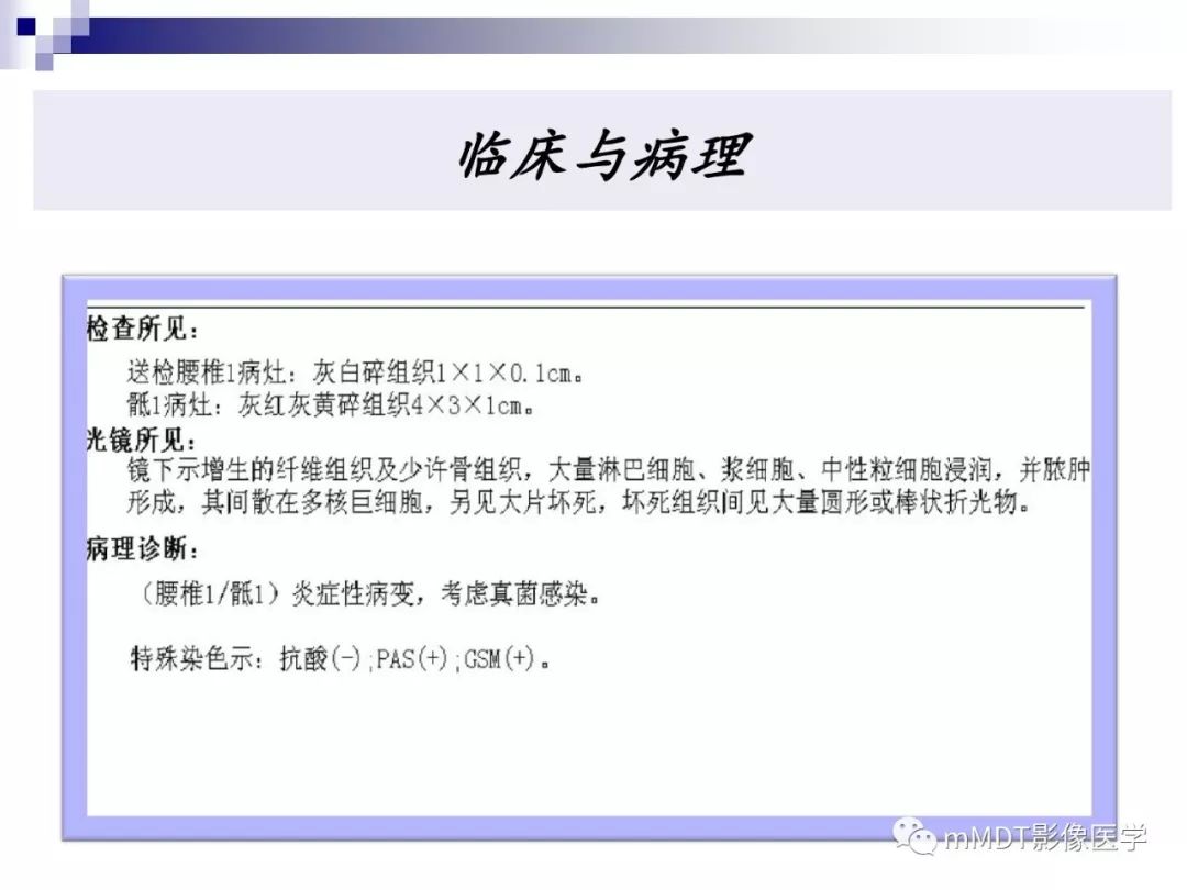 【PPT】多灶性骨病影像分析思路(不常见感染篇)