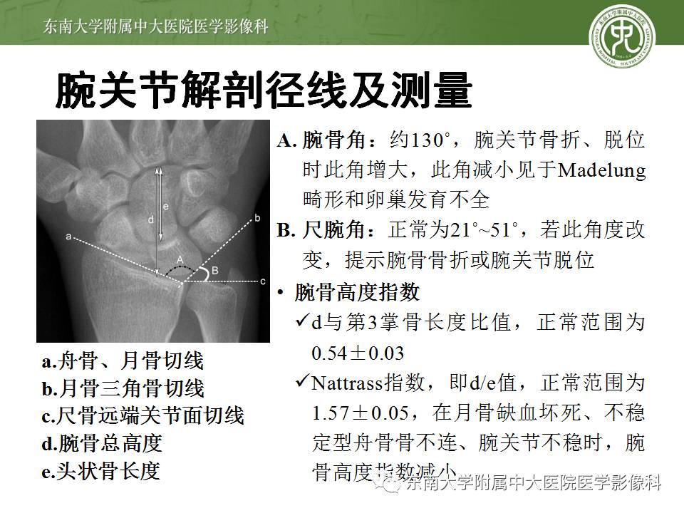 【病例】腕月骨无菌性坏死1例X线MR影像诊断
