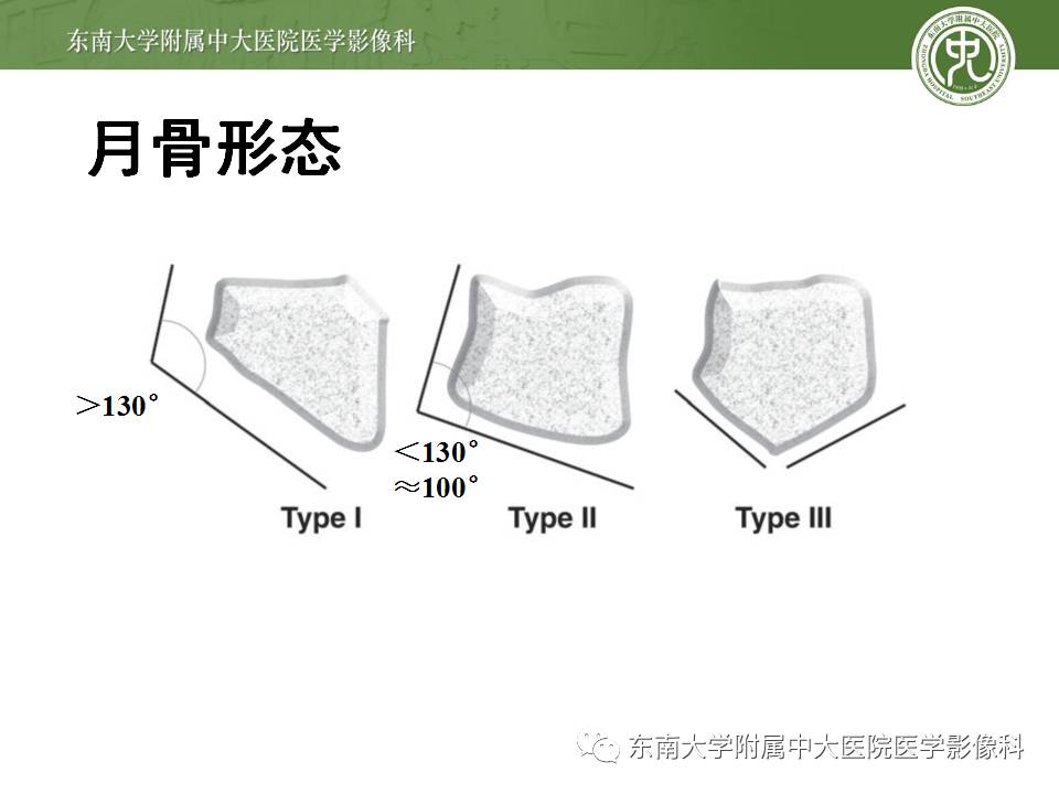 【病例】腕月骨无菌性坏死1例X线MR影像诊断