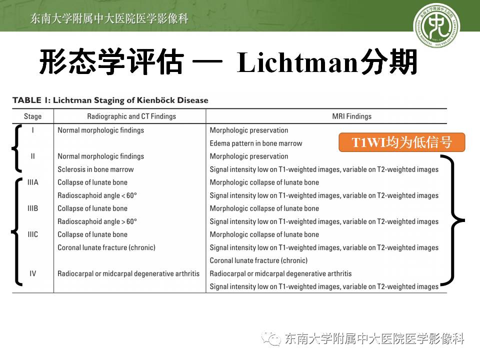 【病例】腕月骨无菌性坏死1例X线MR影像诊断