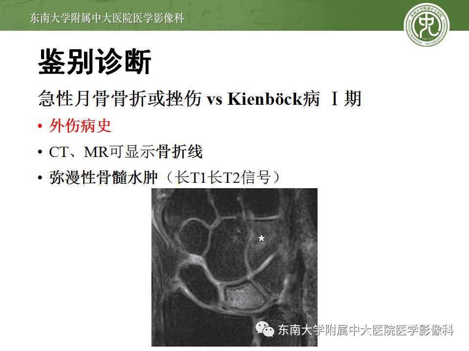 【病例】腕月骨无菌性坏死1例X线MR影像诊断