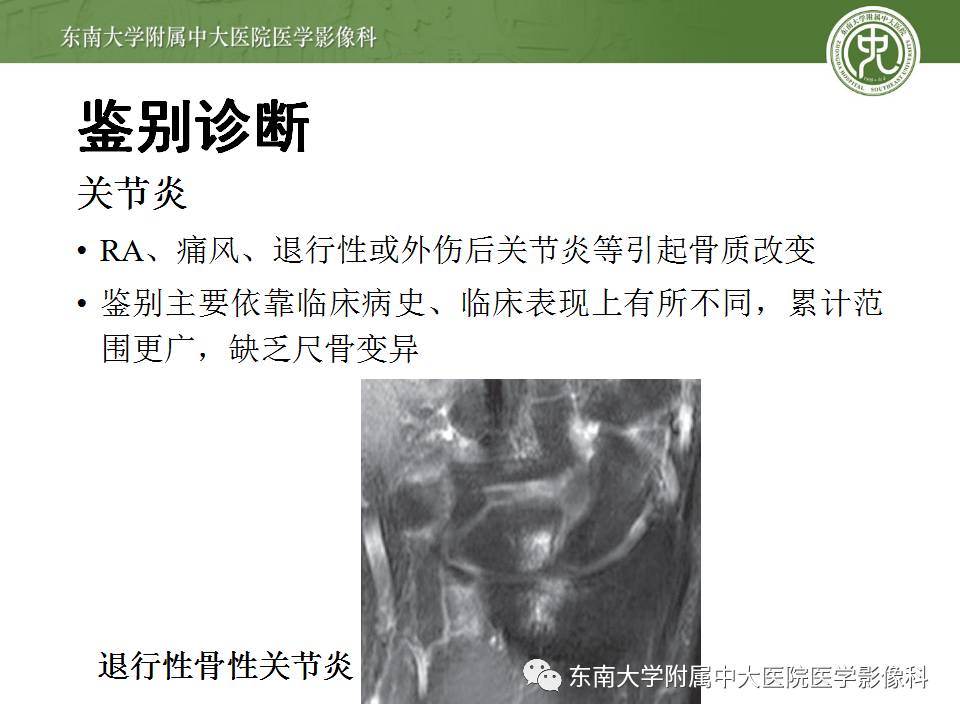 【病例】腕月骨无菌性坏死1例X线MR影像诊断