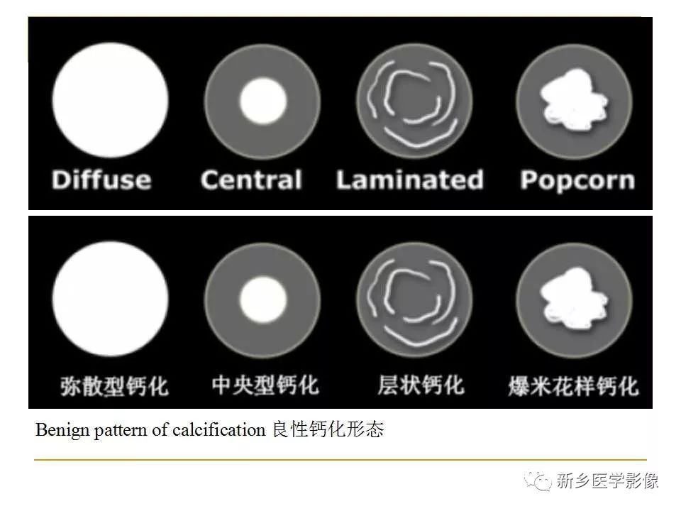 【PPT】孤立性肺结节：使用CT和PET/CT鉴别良恶性