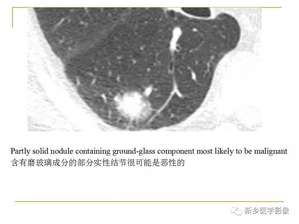 【PPT】孤立性肺结节：使用CT和PET/CT鉴别良恶性