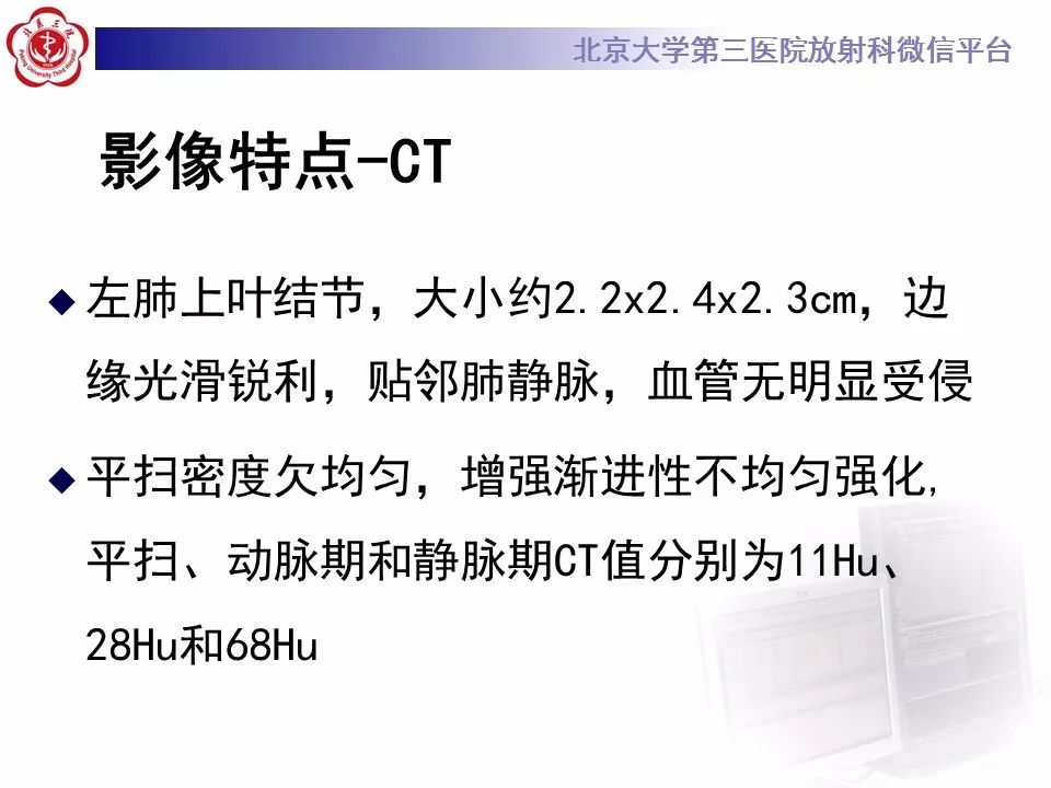【病例】原发肺神经鞘瘤1例CT影像表现