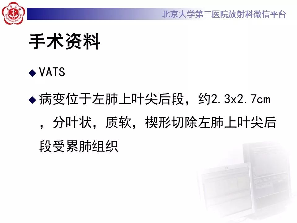 【病例】原发肺神经鞘瘤1例CT影像表现