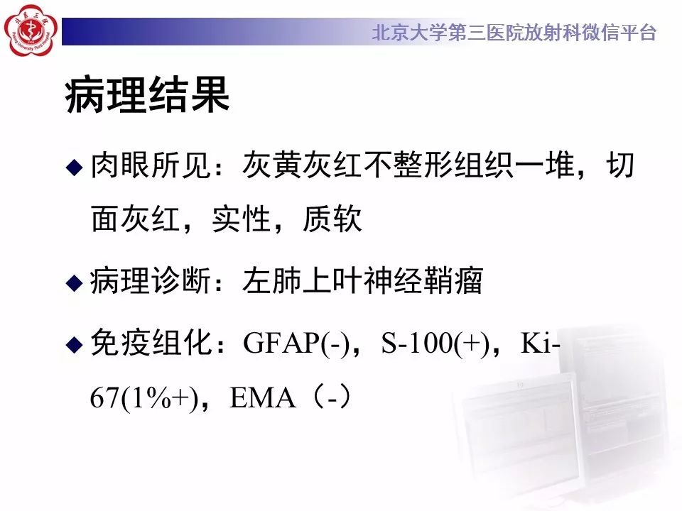 【病例】原发肺神经鞘瘤1例CT影像表现