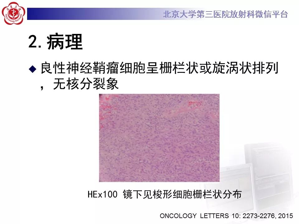 【病例】原发肺神经鞘瘤1例CT影像表现