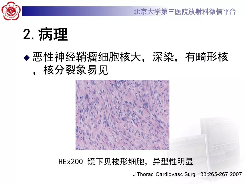 【病例】原发肺神经鞘瘤1例CT影像表现