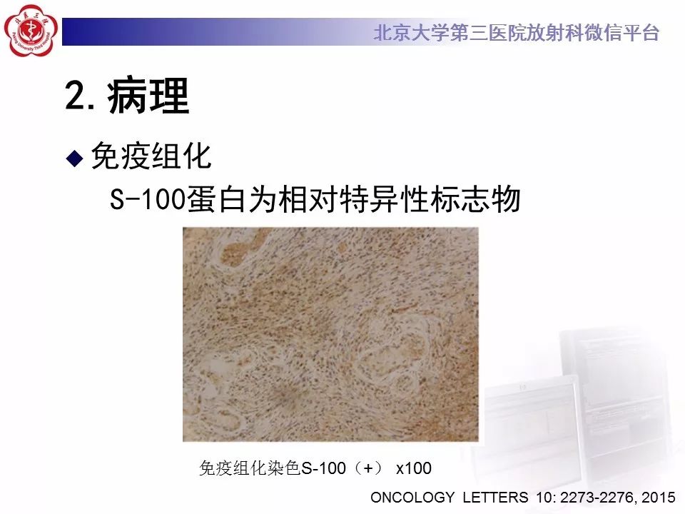 【病例】原发肺神经鞘瘤1例CT影像表现
