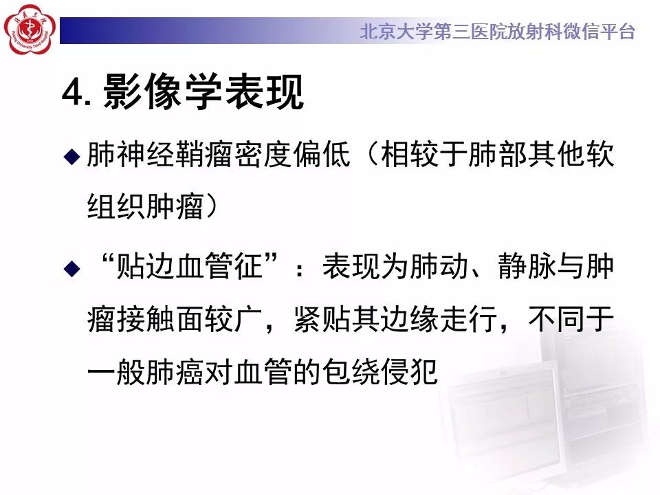 【病例】原发肺神经鞘瘤1例CT影像表现