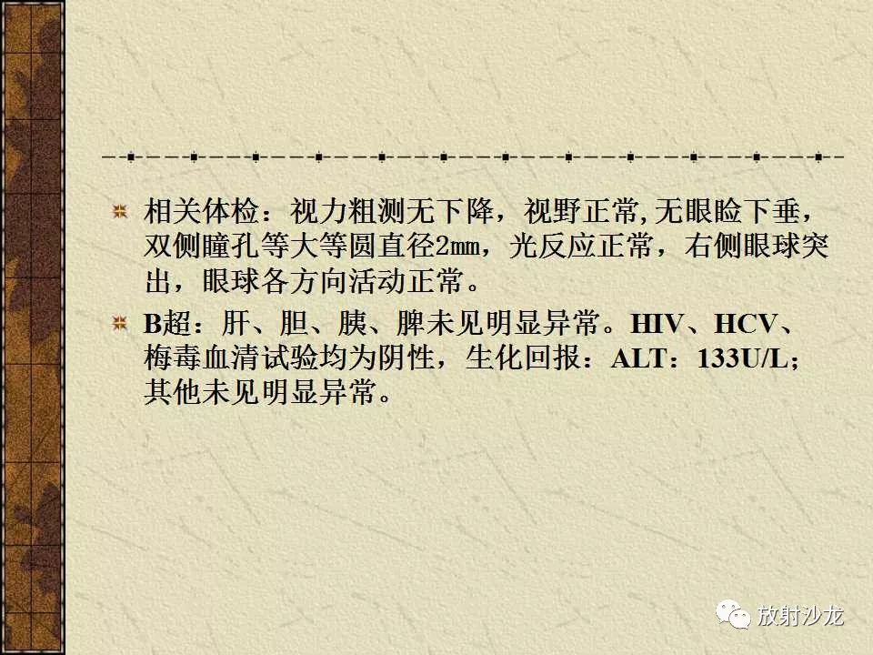 【病例】右侧眼眶-海绵窦旁畸胎瘤1例MR