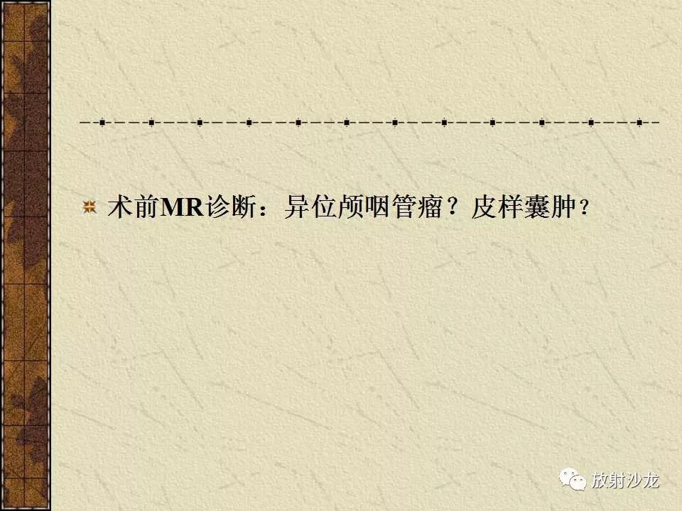 【病例】右侧眼眶-海绵窦旁畸胎瘤1例MR