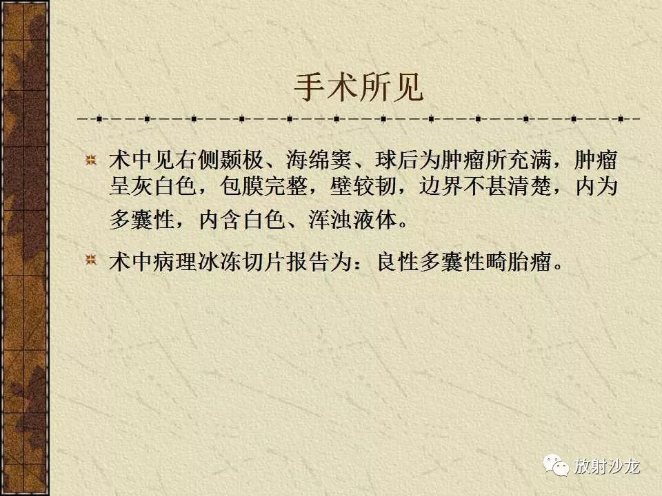 【病例】右侧眼眶-海绵窦旁畸胎瘤1例MR