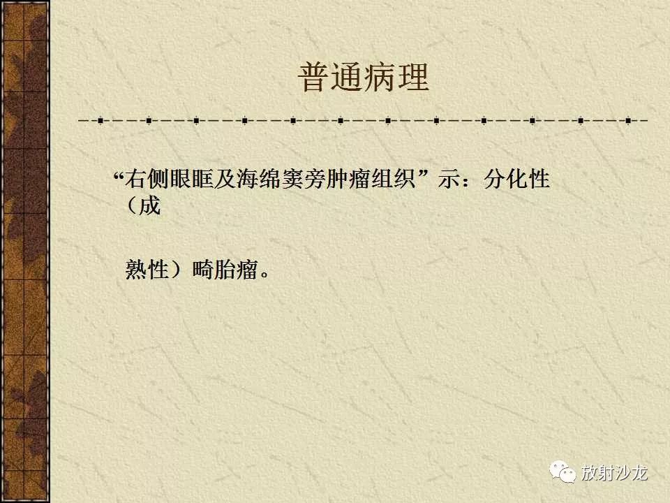 【病例】右侧眼眶-海绵窦旁畸胎瘤1例MR