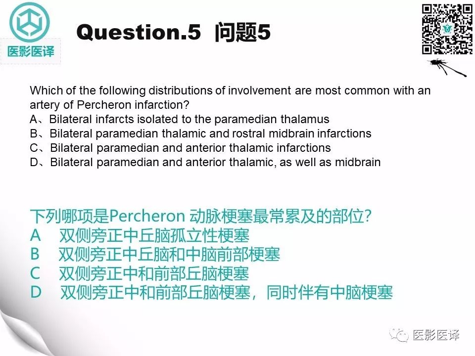 【病例】Percheron动脉梗塞1例CT及MR
