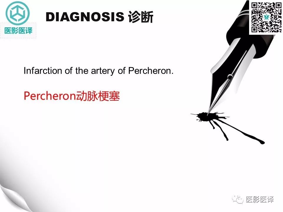 【病例】Percheron动脉梗塞1例CT及MR
