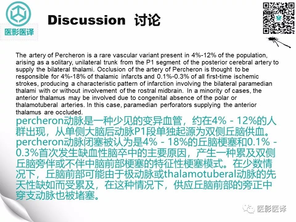 【病例】Percheron动脉梗塞1例CT及MR